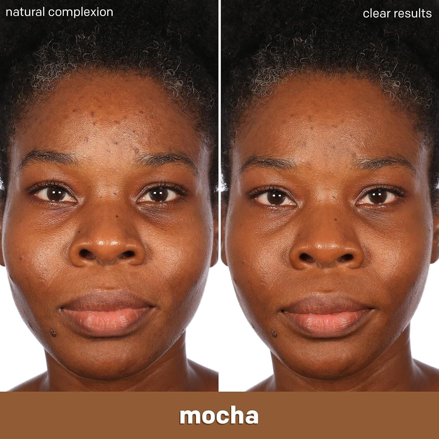 Almay Clear Complexion Acne Foundation Makeup with Salicylic Acid -…