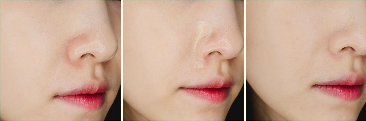 TOUCH IN SOL Pretty Filter Perfect Finish Foundation 35g #03 Medium Tan K-Beauty